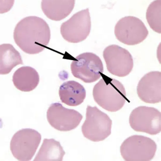 Babesia Species Tiny But Mighty